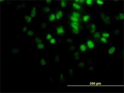 Immunocytochemistry/Immunofluorescence: AKT2 Antibody (1F3) [H00000208-M05] - Analysis of monoclonal antibody to AKT2 on HeLa cell. Antibody concentration 10 ug/ml