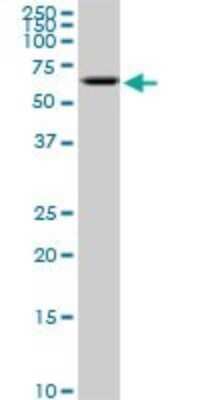 Western Blot: AKT2 Antibody (1F3) [H00000208-M05] - Analysis of AKT2 expression in PC-12 (Cat # L012V1).