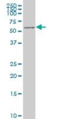 Western Blot: AKT2 Antibody (1F3) [H00000208-M05] - Analysis of AKT2 expression in Jurkat (Cat # L017V1).