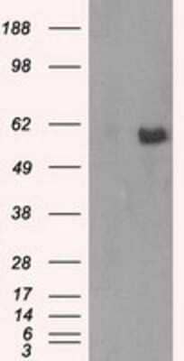 Western Blot: AKT2 Antibody (4H7) [NBP2-02231] - HEK293T cells were transfected with the pCMV6-ENTRY control (Left lane) or pCMV6-ENTRY AKT2 (Right lane) cDNA for 48 hrs and lysed. Equivalent amounts of cell lysates (5 ug per lane) were separated by SDS-PAGE and immunoblotted with anti-AKT2.