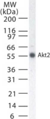 Western Blot: AKT2 Antibody (95C657.1.2) [NB100-56676] - analysis of Akt2 using this antibody.