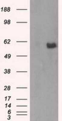 Western Blot: AKT2 Antibody (OTI4H7) - Azide and BSA Free [NBP2-70146] - HEK293T cells were transfected with the pCMV6-ENTRY control (Left lane) or pCMV6-ENTRY AKT2 (Right lane) cDNA for 48 hrs and lysed. Equivalent amounts of cell lysates (5 ug per lane) were separated by SDS-PAGE and immunoblotted with anti-AKT2.