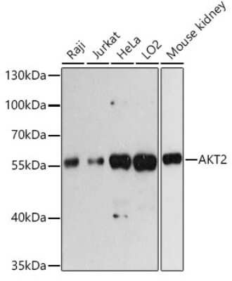 Western Blot: AKT2 Antibody [NBP3-05341] - Western blot analysis of extracts of various cell lines, using AKT2 antibody (NBP3-05341) at 1:3000 dilution. Secondary antibody: HRP Goat Anti-Rabbit IgG (H+L) at 1:10000 dilution. Lysates/proteins: 25ug per lane. Blocking buffer: 3% nonfat dry milk in TBST. Detection: ECL Basic Kit. Exposure time: 60s.