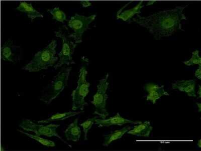 Immunocytochemistry/Immunofluorescence: AKT2 Antibody (X1) [H00000208-M06] - Analysis of monoclonal antibody to AKT2 on HeLa cell. Antibody concentration 10 ug/ml