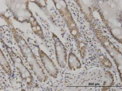 Immunohistochemistry-Paraffin: AKT2 Antibody (X1) [H00000208-M06] - Analysis of monoclonal antibody to AKT2 on formalin-fixed paraffin-embedded human small Intestine. Antibody concentration 3 ug/ml