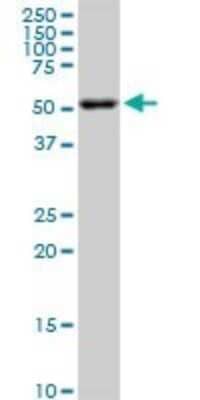 Western Blot: AKT2 Antibody (X1) [H00000208-M06] - Analysis of AKT2 expression in PC-12 (Cat # L012V1).