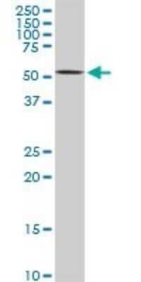 Western Blot: AKT2 Antibody (X1) [H00000208-M06] - Analysis of AKT2 expression in Raw 264.7 (Cat # L024V1).