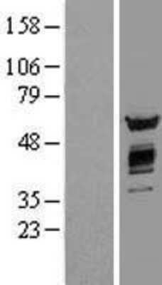 Western Blot AKT2 Overexpression Lysate