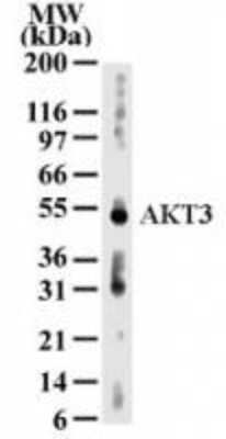 Western Blot: AKT3 Antibody (66C1247) - Azide and BSA Free [NBP2-80567] - Analysis for AKT3 using NB600-1298 at 2 ug/ml dilution against 30 ug/lane of human kidney lysate. Image from the standard format of this antibody.