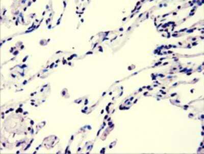 Immunohistochemistry-Paraffin: AKT3 Antibody (9B2) [NBP1-47657] - Staining of paraffin-embedded Human lung tissue using anti-AKT3 mouse monoclonal antibody.