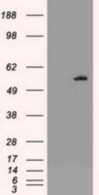 Western Blot: AKT3 Antibody (9B2) [NBP1-47657] - HEK293T cells were transfected with the pCMV6-ENTRY control (Left lane) or pCMV6-ENTRY AKT3 (Right lane) cDNA for 48 hrs and lysed. Equivalent amounts of cell lysates (5 ug per lane) were separated by SDS-PAGE and immunoblotted with anti-AKT3.