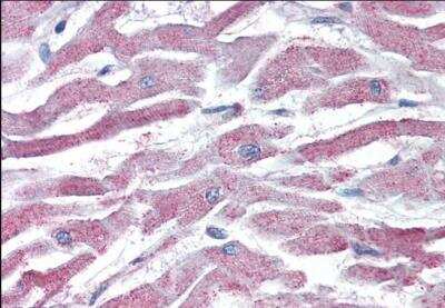 Immunohistochemistry-Paraffin: AKT3 Antibody [NB100-1480] - staining of paraffin embedded Human Heart. Steamed antigen retrieval with citrate buffer pH 6, AP-staining.