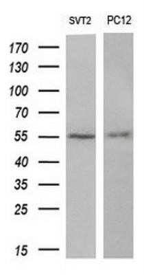 Western Blot: AKT3 Antibody (OTI9B2) - Azide and BSA Free [NBP2-71528] - Analysis of extracts (10ug) from 2 different cell lines by using anti-AKT3 monoclonal antibody at 1:200 dilution.