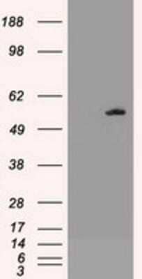 Western Blot: AKT3 Antibody (OTI9B2) - Azide and BSA Free [NBP2-71528] - HEK293T cells were transfected with the pCMV6-ENTRY control (Left lane) or pCMV6-ENTRY AKT3 (Right lane) cDNA for 48 hrs and lysed. Equivalent amounts of cell lysates (5 ug per lane) were separated by SDS-PAGE and immunoblotted with anti-AKT3.