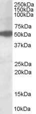 Western Blot: AKT3 Antibody [NB100-1480] - (1ug/ml) staining of HepG2lysate (35ug protein in RIPA buffer). Primary incubation was 1 hour. Detected by chemiluminescence.