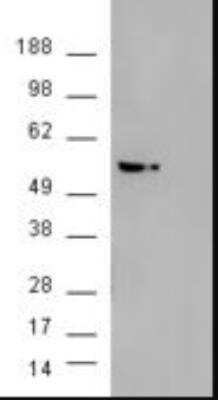 Western Blot: AKT3 Antibody [NB100-1480] - HEK293 overexpressing AKT3 (RC224750) and probed with (mock transfection in second lane)