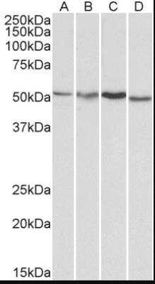 Western Blot: AKT3 Antibody [NB100-1480] - staining of HepG2 (A), Jurkat (B), Mouse Brain (C) and Rat Brain (D) lysates (35ug protein in RIPA buffer). Primary incubation was 1 hour. Detected by chemiluminescence.