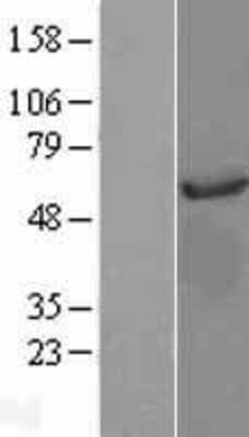 Western Blot: AKT3 Overexpression Lysate (Adult Normal) [NBL1-07443] Left-Empty vector transfected control cell lysate (HEK293 cell lysate); Right -Over-expression Lysate for AKT3.