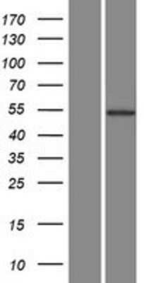 Western Blot: AKT3 Overexpression Lysate (Adult Normal) [NBL1-07444] Left-Empty vector transfected control cell lysate (HEK293 cell lysate); Right -Over-expression Lysate for AKT3.