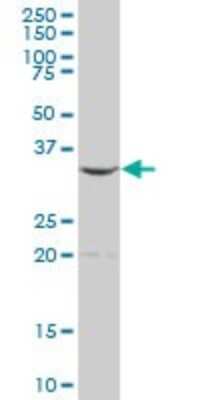 Western Blot: ALAD Antibody [H00000210-B01P] - Analysis of ALAD expression in human liver.