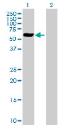 Western Blot: ALAD Antibody [H00000210-B01P] - Analysis of ALAD expression in transfected 293T cell line by ALAD polyclonal antibody.  Lane 1: ALAD transfected lysate(37.29 KDa). Lane 2: Non-transfected lysate.