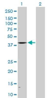 Western Blot: ALAD Antibody [H00000210-D01P] - Analysis of ALAD expression in transfected 293T cell line by ALAD polyclonal antibody.Lane 1: ALAD transfected lysate(37.20 KDa).Lane 2: Non-transfected lysate.