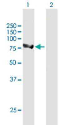 Western Blot: ALDH16A1 Antibody [H00126133-B01P] - Analysis of ALDH16A1 expression in transfected 293T cell line by ALDH16A1 polyclonal antibody.  Lane 1: ALDH16A1 transfected lysate(88.22 KDa). Lane 2: Non-transfected lysate.