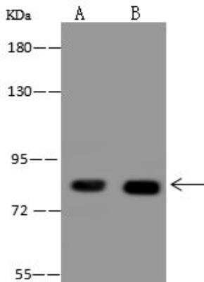 Western Blot: ALDH16A1 Antibody [NBP3-12645] - Lane A: HeLa Whole Cell LysateLane B: Jurkat Whole Cell LysateLysates/proteins at 30 ug per lane.SecondaryGoat Anti-Rabbit IgG (H+L)/HRP at 1/10000 dilution.Developed using the ECL technique.Performed under reducing conditions.Predicted band size:85 kDaObserved band size:85 kDa