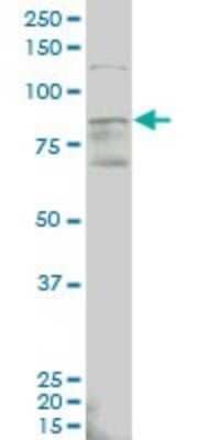 Western Blot: ALDH18A1 Antibody (2B5) [H00005832-M01] - ALDH18A1 monoclonal antibody (M01), clone 2B5 Analysis of ALDH18A1 expression in MCF-7.