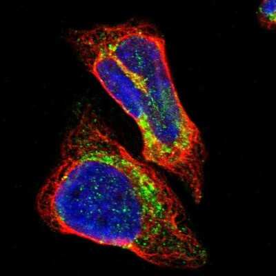 Immunocytochemistry/ Immunofluorescence ALDH18A1 Antibody