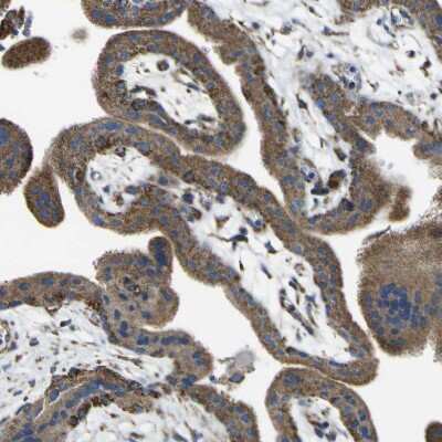 Immunohistochemistry-Paraffin ALDH18A1 Antibody