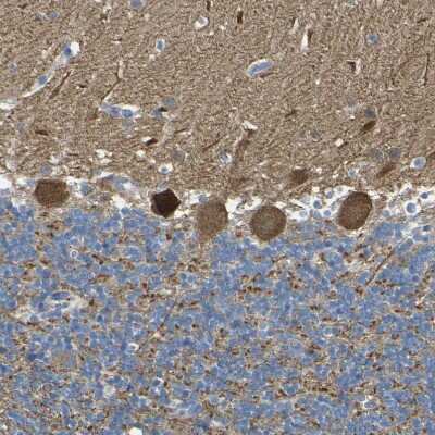 Immunohistochemistry-Paraffin ALDH18A1 Antibody