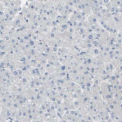 Immunohistochemistry-Paraffin: ALDH18A1 Antibody [NBP1-83324] - Staining of human liver shows no positivity in hepatocytes as expected.