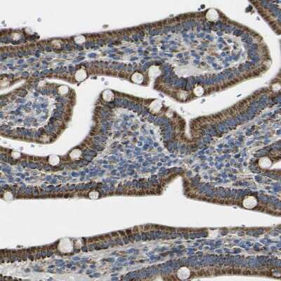 Immunohistochemistry-Paraffin: ALDH18A1 Antibody [NBP1-83324] - Staining of human gastrointestinal shows strong granular cytoplasmic positivity in glandular cells.