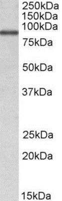 Western Blot ALDH18A1 Antibody