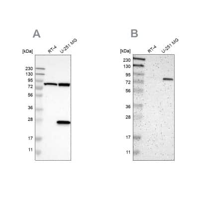 Western Blot: ALDH18A1 Antibody [NBP1-83324] - Analysis using Anti-ALDH18A1 antibody NBP1-83324 (A) shows similar pattern to independent antibody NBP1-83325 (B).