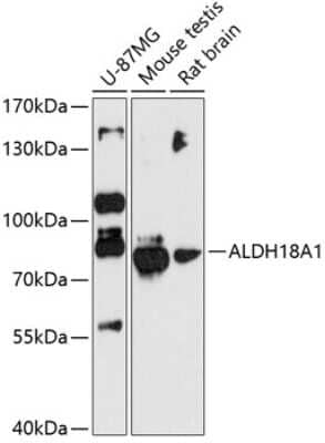 Western Blot: ALDH18A1 Antibody [NBP2-92069] - Analysis of extracts of various cell lines, using ALDH18A1 at 1:3000 dilution.Secondary antibody: HRP Goat Anti-Rabbit IgG (H+L) at 1:10000 dilution.Lysates/proteins: 25ug per lane.Blocking buffer: 3% nonfat dry milk in TBST.Detection: ECL Basic Kit .Exposure time: 90s.