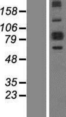 Western Blot ALDH18A1 Overexpression Lysate