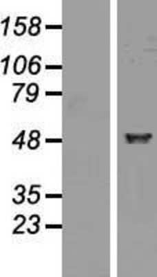 Western Blot: ALDH1A2 Overexpression Lysate (Adult Normal) [NBP2-05210] Left-Empty vector transfected control cell lysate (HEK293 cell lysate); Right -Over-expression Lysate for ALDH1A2.
