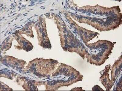 Immunohistochemistry: ALDH1A3 Antibody (OTI4E8) - Azide and BSA Free [NBP2-70154] - Analysis of Human prostate tissue. (Heat-induced epitope retrieval by 10mM citric buffer, pH6.0, 120C for 3min)