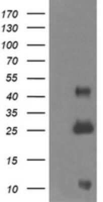 Western Blot: ALDH1A3 Antibody (OTI4E8) - Azide and BSA Free [NBP2-70154] - Negative control E. coli lysate (Left lane) or E. coli lysate containing recombinant protein fragment for human ALDH1A3 (NP_000648) gene (the fusion of amino acids 1-100 and 413-512) (Right lane). Equivalent amounts (5 ug per lane) were separated by SDS-P