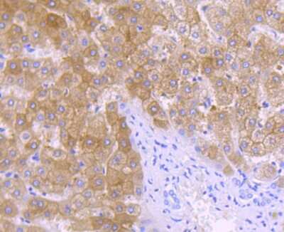 Immunohistochemistry-Paraffin: ALDH1L1 Antibody (JU53-54) [NBP2-75399] - Analysis of paraffin-embedded human liver tissue using anti-ALDH1L1 antibody. Counter stained with hematoxylin.