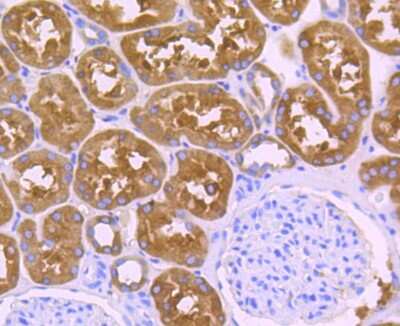 Immunohistochemistry-Paraffin: ALDH1L1 Antibody (JU53-54) [NBP2-75399] - Analysis of paraffin-embedded human kidney tissue using anti-ALDH1L1 antibody. Counter stained with hematoxylin.
