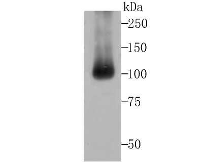 Western Blot: ALDH1L1 Antibody (JU53-54) [NBP2-75399] - Analysis of ALDH1L1 on mouse liver tissue lysates using anti-ALDH1L1 antibody at 1/500 dilution.