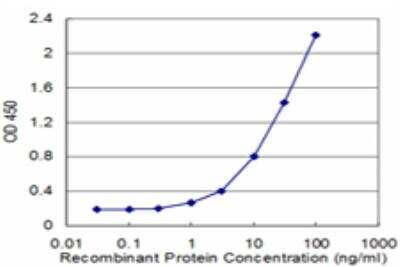ELISA: ALDH2 Antibody (4F10) [H00000217-M10] - Detection limit for recombinant GST tagged ALDH2 is approximately 1ng/ml as a capture antibody.