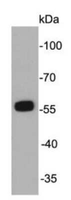 Western Blot: ALDH2 Antibody (7-D8) [NBP2-67131] - Analysis on HepG2 cell lysate using anti- ALDH2 mouse mAb.