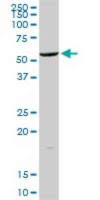 Western Blot: ALDH2 Antibody [H00000217-D01P] - Analysis of ALDH2 expression in human liver.