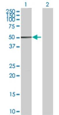 Western Blot: ALDH2 Antibody [H00000217-D01P] - Analysis of ALDH2 expression in transfected 293T cell line by ALDH2 polyclonal antibody.Lane 1: ALDH2 transfected lysate(56.40 KDa).Lane 2: Non-transfected lysate.