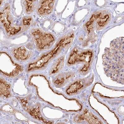 Immunohistochemistry-Paraffin: ALDH3B1 Antibody [NBP2-32638] - Staining of human kidney shows strong membranous positivity in cells of tubules.