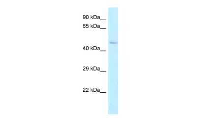 Western Blot: ALDH3B2 Antibody [NBP2-86975] - WB Suggested Anti-ALDH3B2 Antibody. Titration: 1.0 ug/ml. Positive Control: Fetal Lung